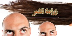 خطوات زراعة الشعر
