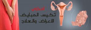 احذري تكيس المبايض "الأعراض و العلاج"