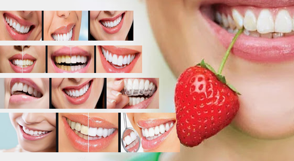 أطعمة تساعد على تبييض أسنانك